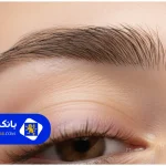لیست ۱۰ تا از بهترین کاشت ابرو در تهران +شماره تلفن + آدرس