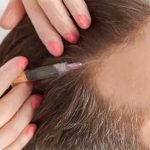 اگر از ریزش مو کلافه شده‌اید، این روش‌ها را امتحان کنید