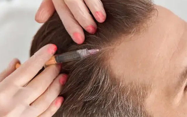 اگر از ریزش مو کلافه شده‌اید، این روش‌ها را امتحان کنید