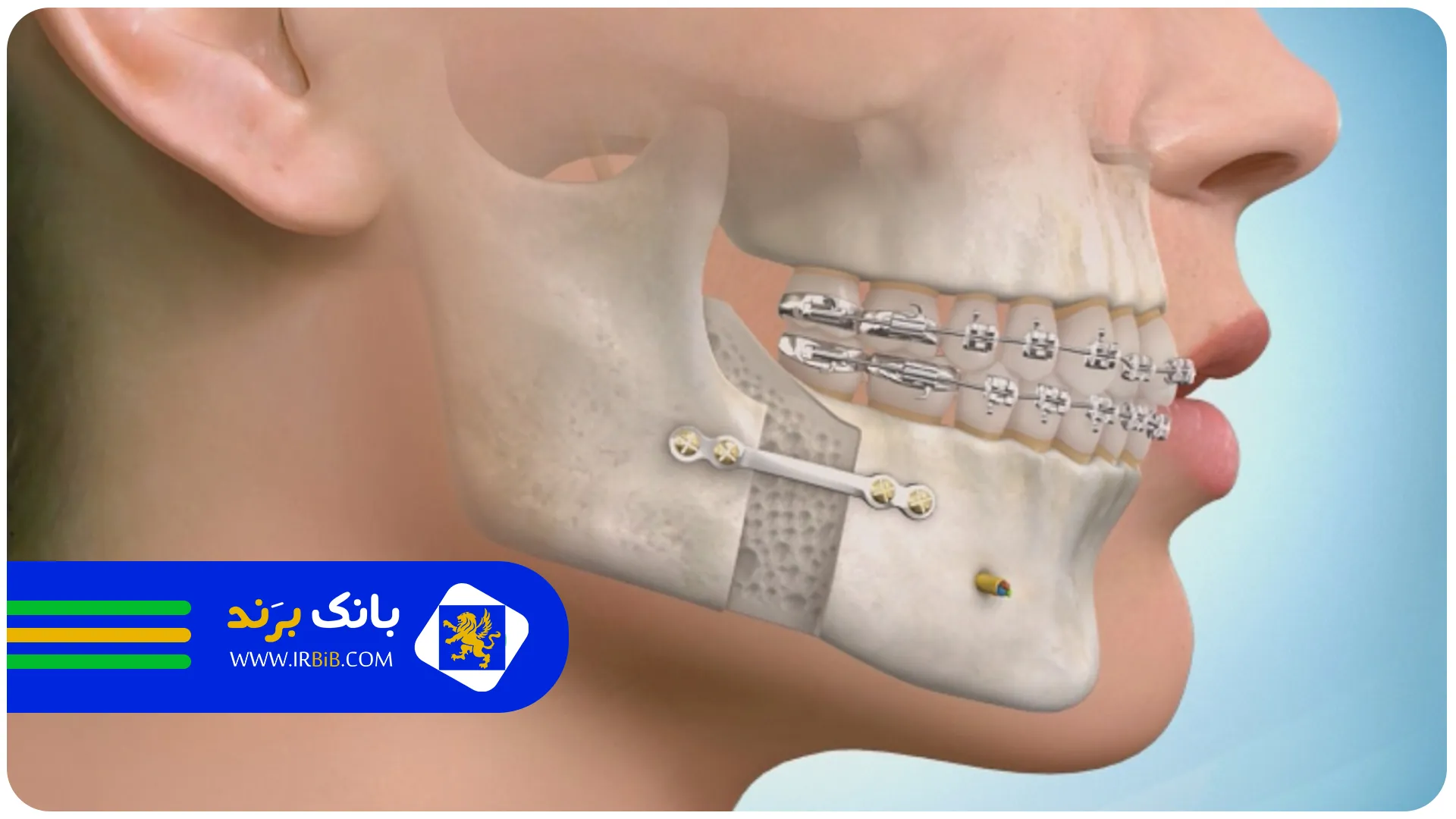 تکنولوژی | بهترین جراح فک و صورت تهران