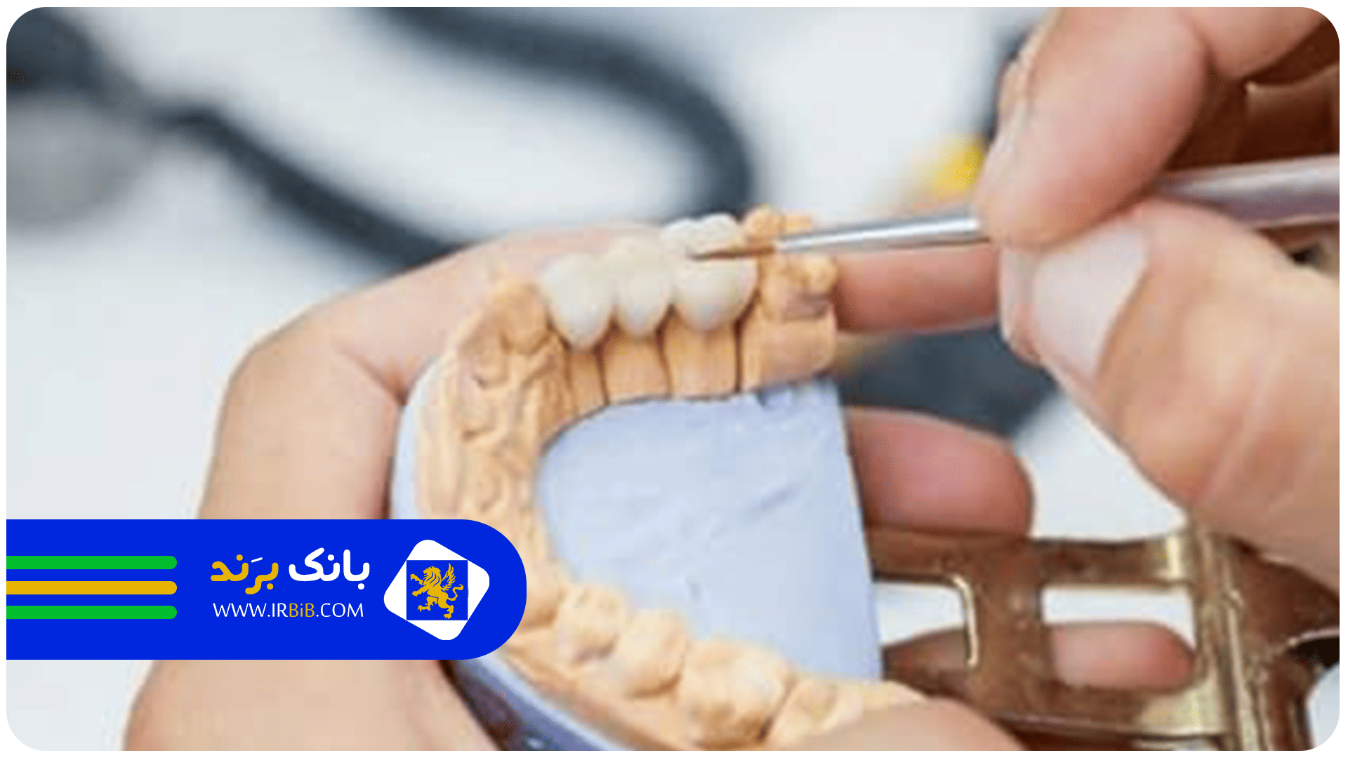 بهترین دندانسازی مصنوعی در تهران | بانک برند