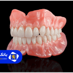 لیست ۱۰ تا از بهترین دندانسازی مصنوعی در تهران + آدرس و تلفن