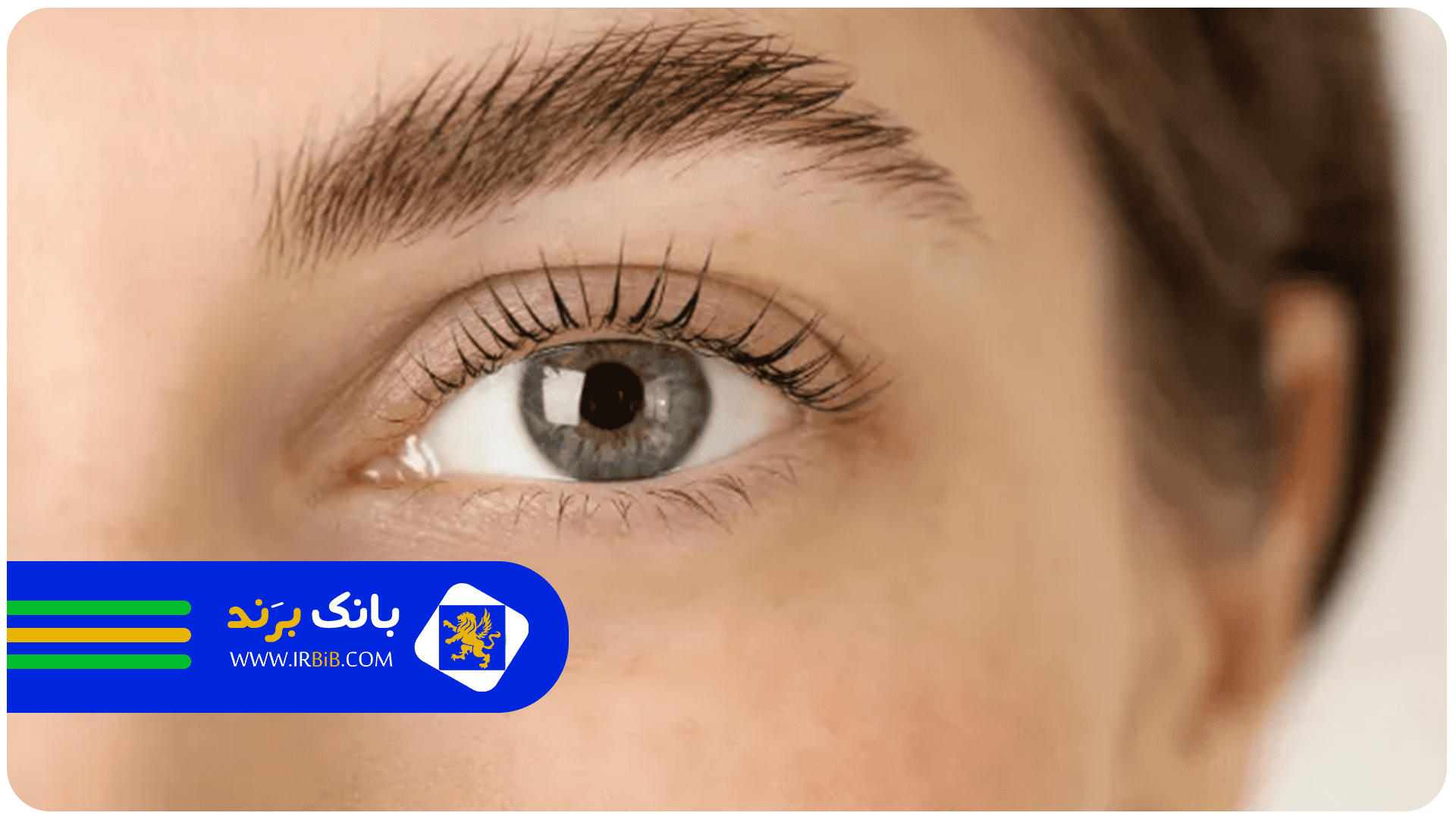 بهترین کلینیک کاشت ابرو در تهران | بانک برند