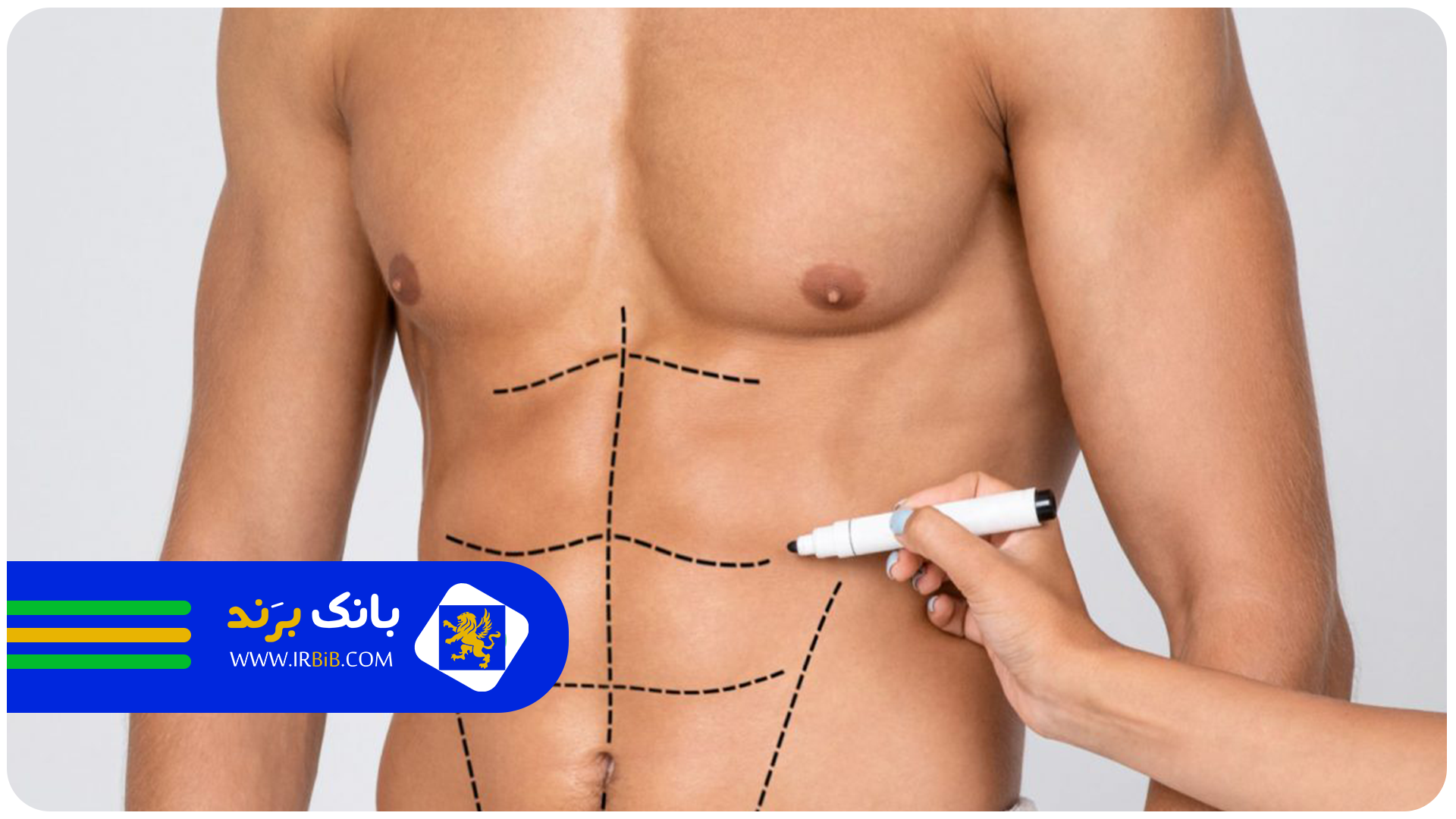 بهترین دکتر زن پیکرتراشی در تهران | بانک برند