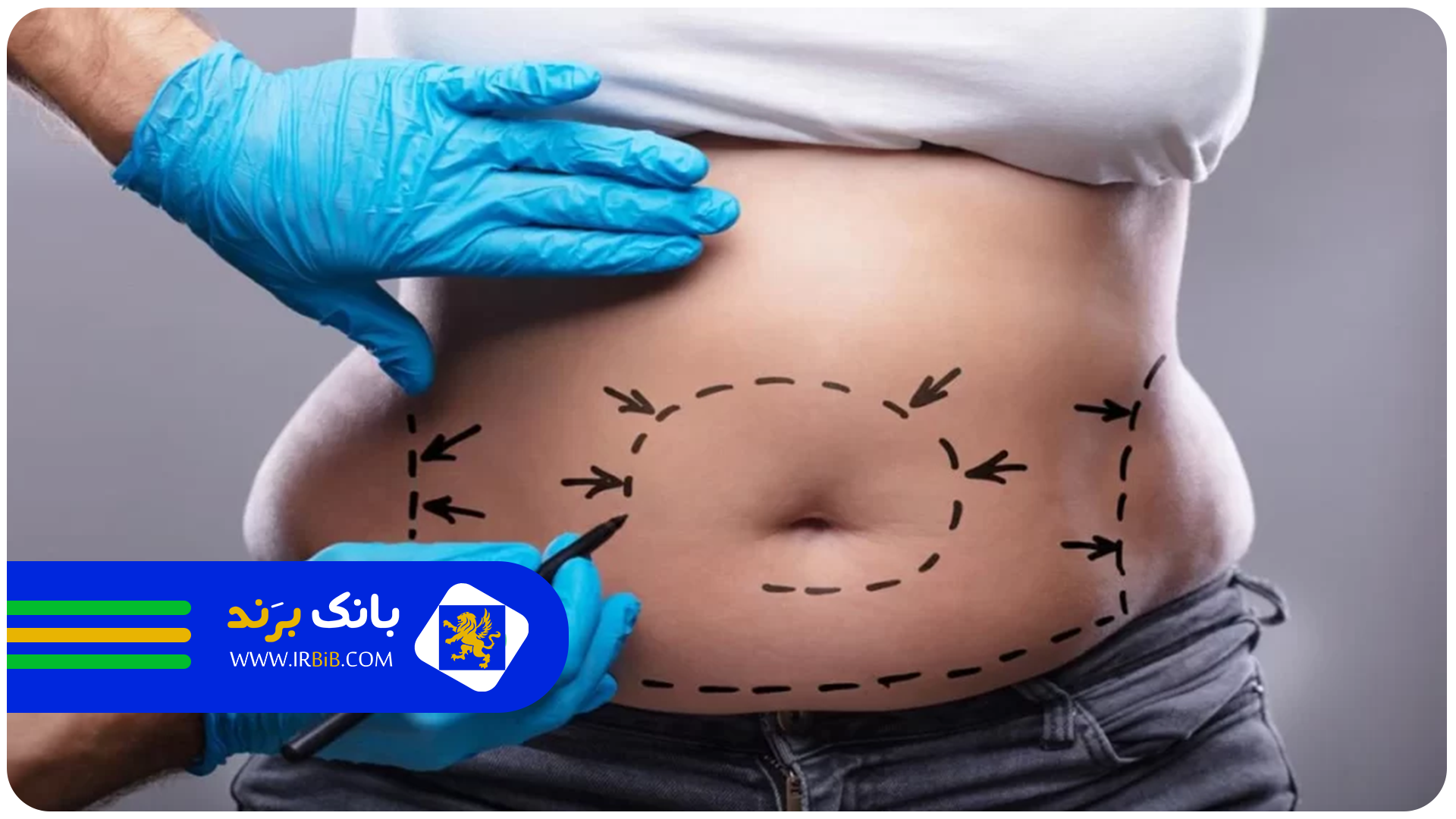 بهترین دکتر زن پیکرتراشی در تهران | بانک برند