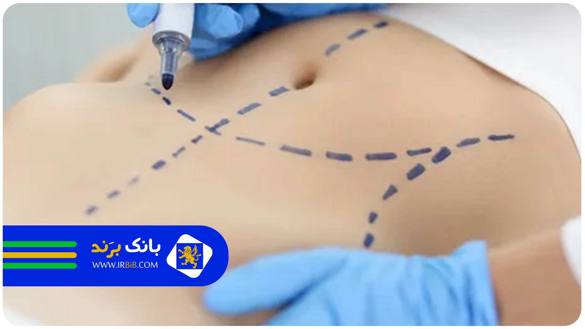 بهترین دکتر زن پیکرتراشی در تهران | بانک برند