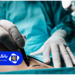 ۲۰سوال پرتکرار که قبل از مراجعه به بهترین دکتر پیکرتراشی در تهران باید بررسی کنید