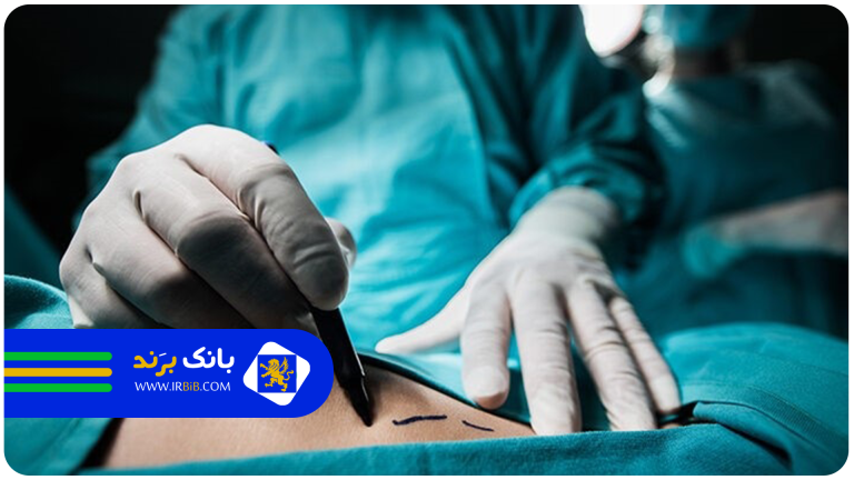 سوالات پرتکرار دکتر پیکرتراشی در تهران