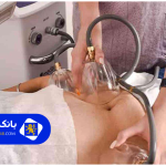 روش‌های لاغری موضعی در تهران (راهنمای کامل دستگاه‌ها، هزینه‌ها و عوارض)