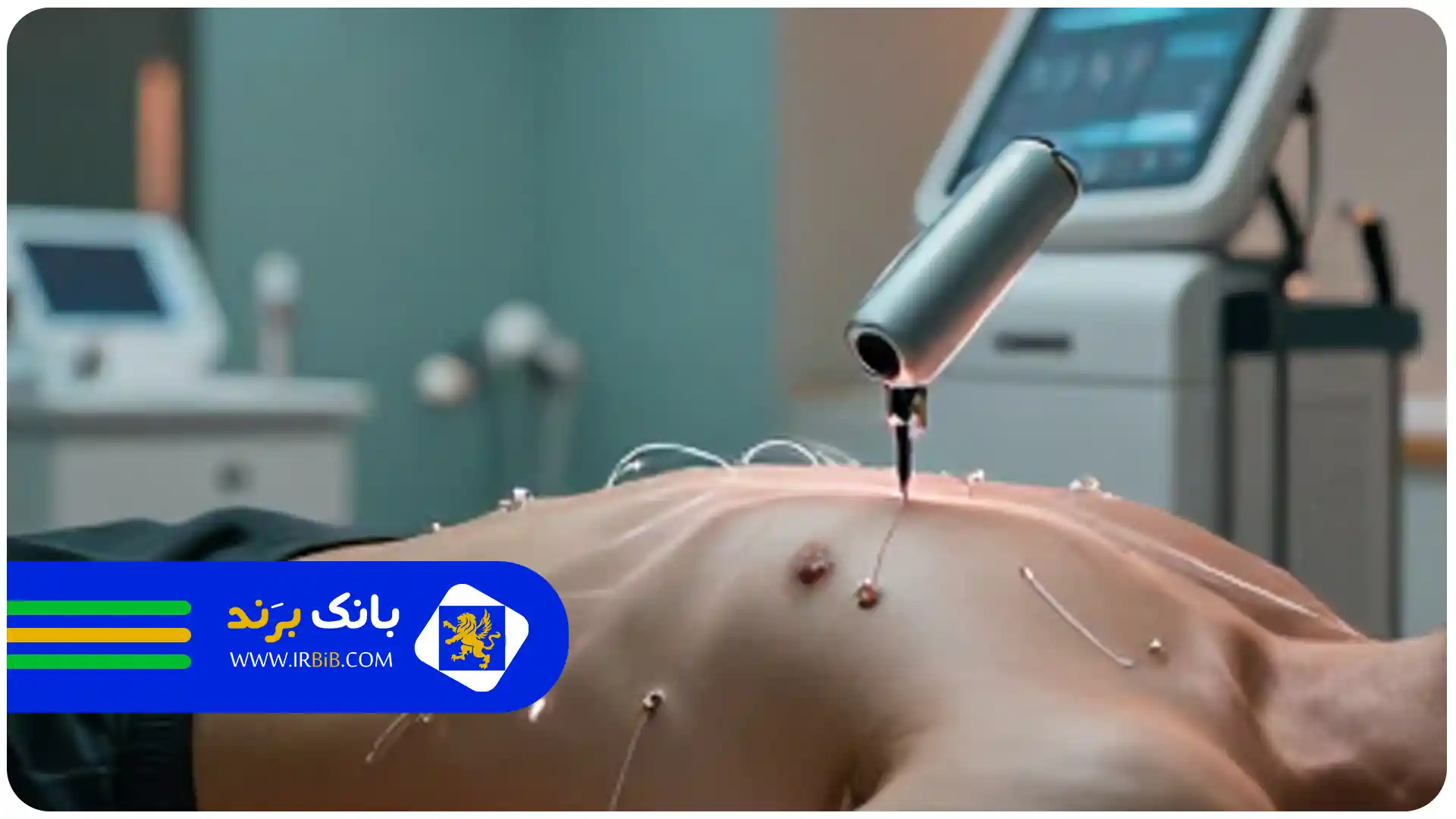 پیکرتراشی شکم و پهلو